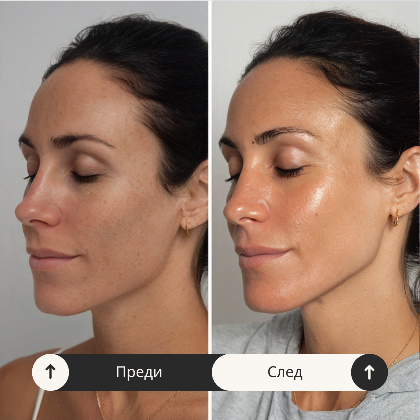 Маска с PDRN и колаген