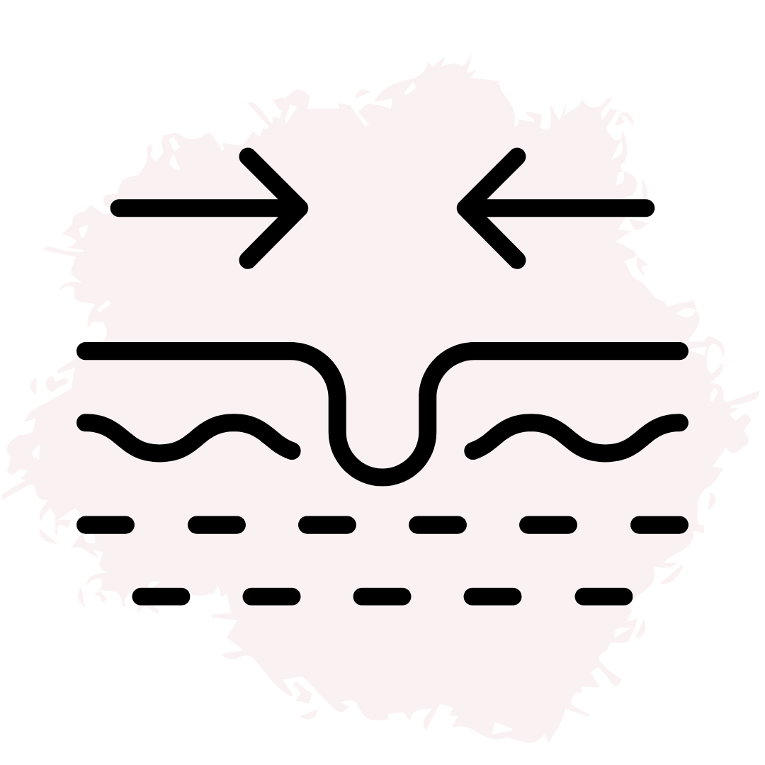 Свива порите